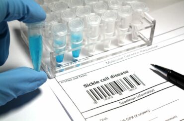 Blue-gloved fingers hold a vial next to a rack of laboratory test tubes, on top of a paper that reads "Sickle cell disease"