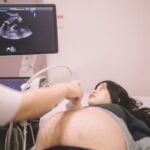 Ultrasound on pregnant patient