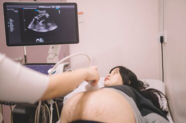 Ultrasound on pregnant patient